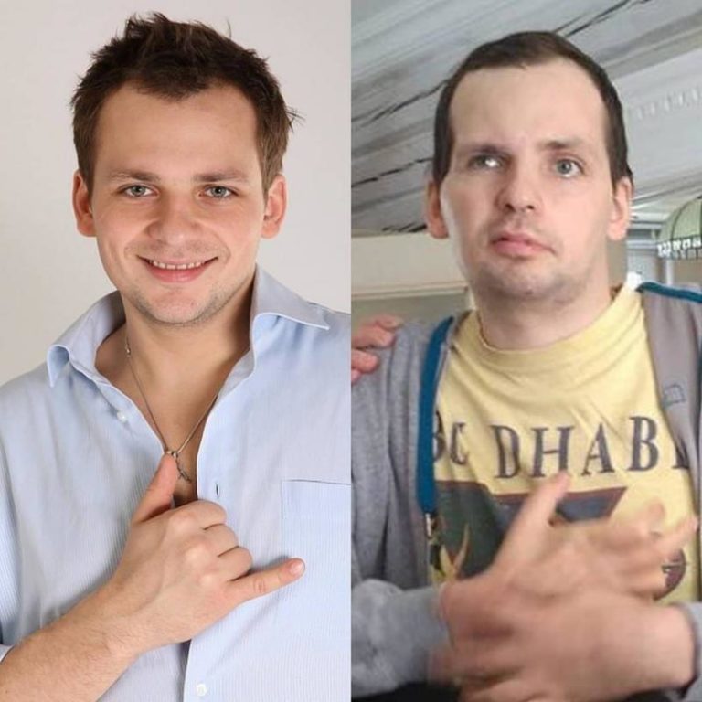 Николай носков инсульт до и после